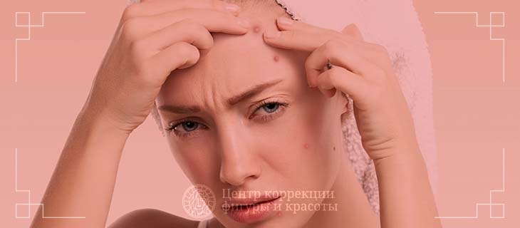 Революционная технология elos предлагает долгосрочные решения для лечения акне и рубцов постакне